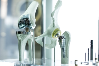 Artificial Joints